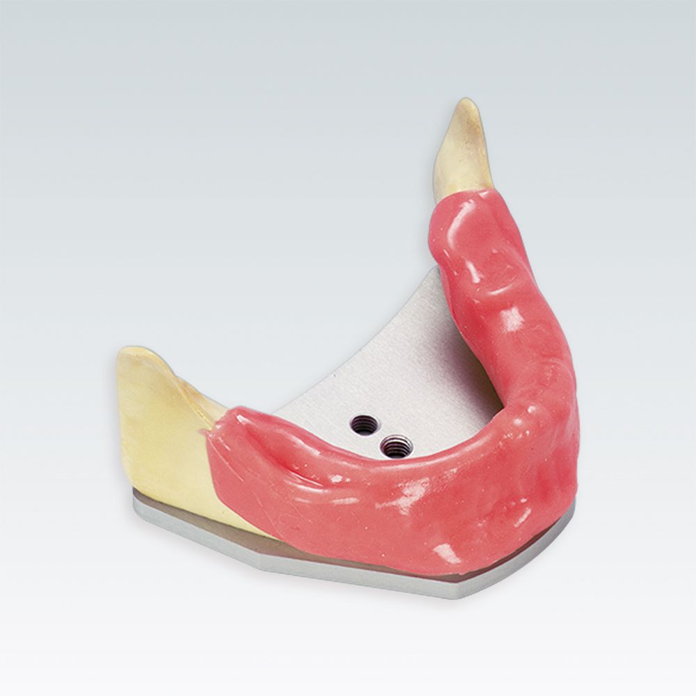 A-J KWA Стоматологическая модель беззубой нижней челюсти для имплантации  с монтажной пластиной и слизистой
