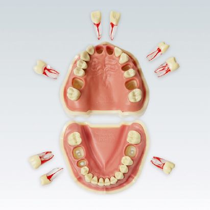 ANA-4 VEM 903 Стоматологическая модель верхней и нижней челюсти с 8-ю эндозубами с полноразмерными корнями