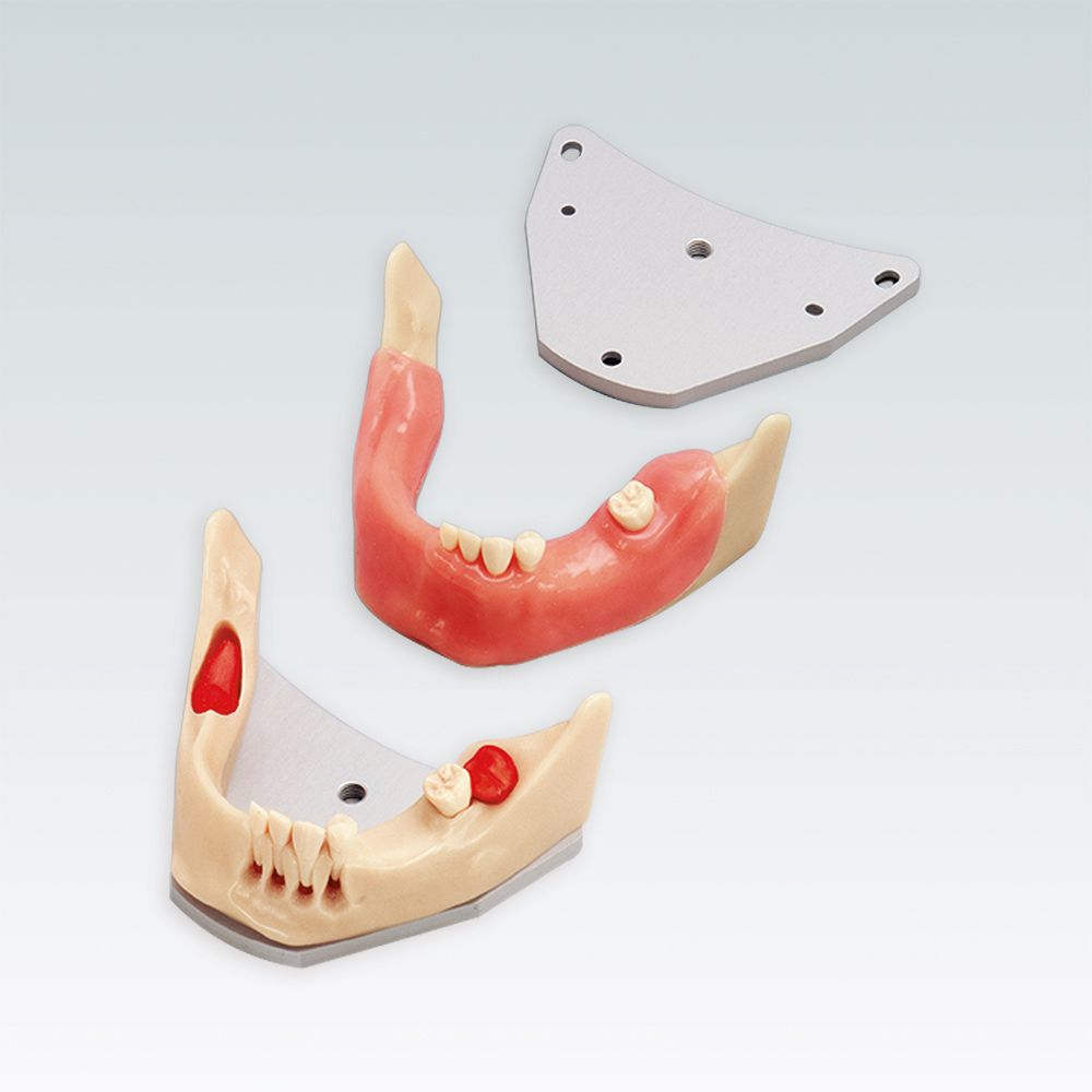A-J OP UK Стоматологическая модель нижней челюсти для хирургии с ретинированными зубами "мудрости"