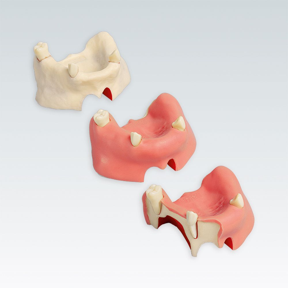A-J F SOK Стоматологическая модель верхней челюсти для имплантологического тренинга с мембраной Шнайдера, без слизистой