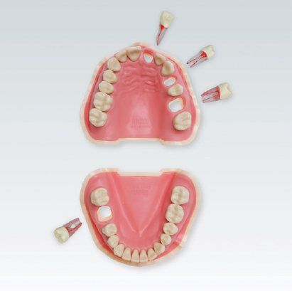 ANA-4 VEM 901 Стоматологическая модель верхней и нижней челюсти с 4-мя эндозубами с полноразмерными корнями