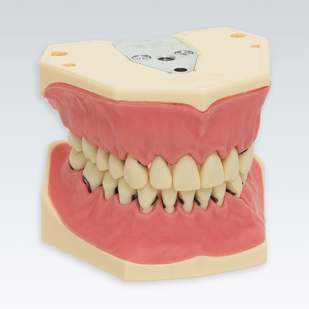A-PZ Стоматологическая модель верхней и нижней челюсти с ранним пародонтитом