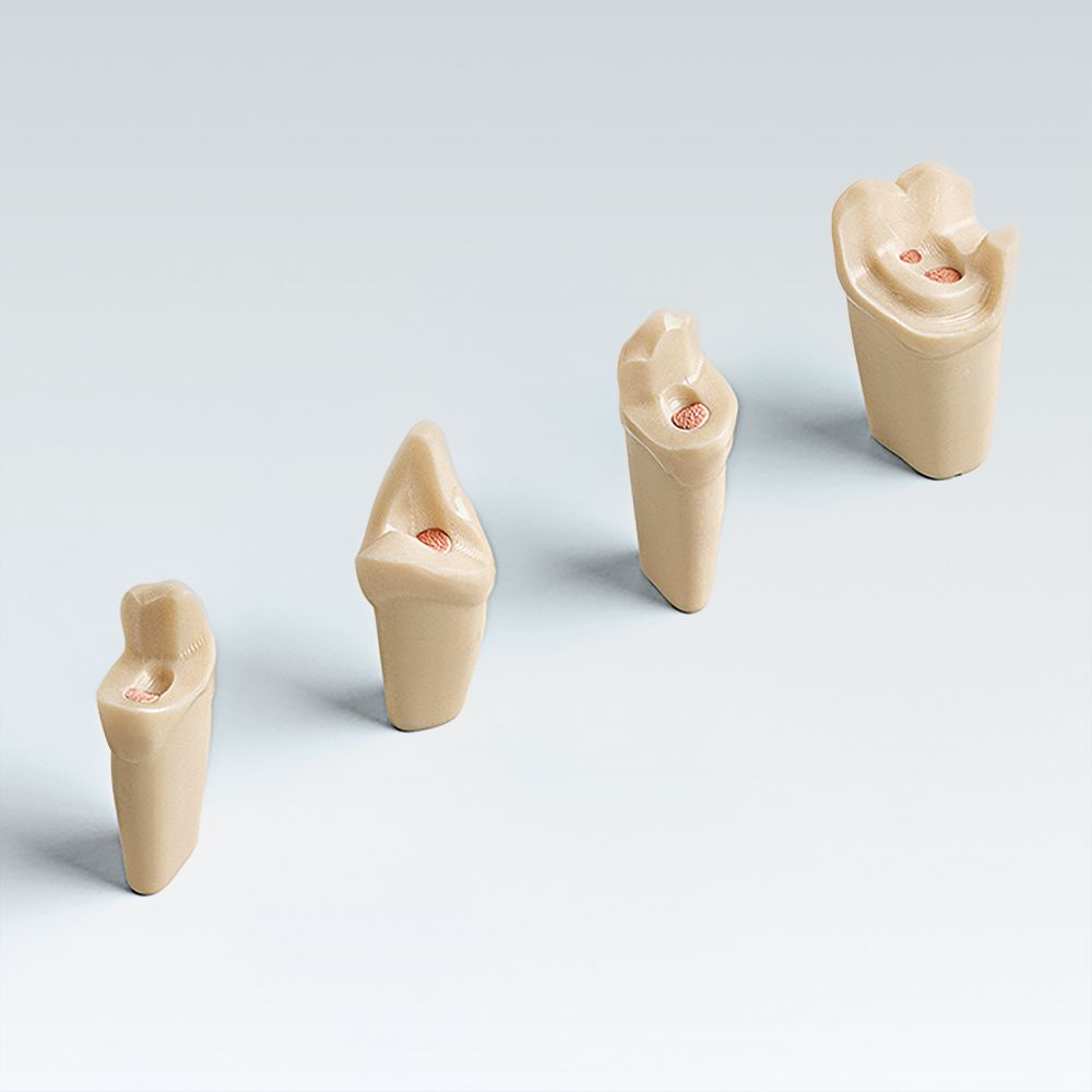 ANKA-4 ZEE Зуб для ANKA-4 (V) после лечения корневых каналов гуттаперчевыми штифтами, на фиксации "Click In"