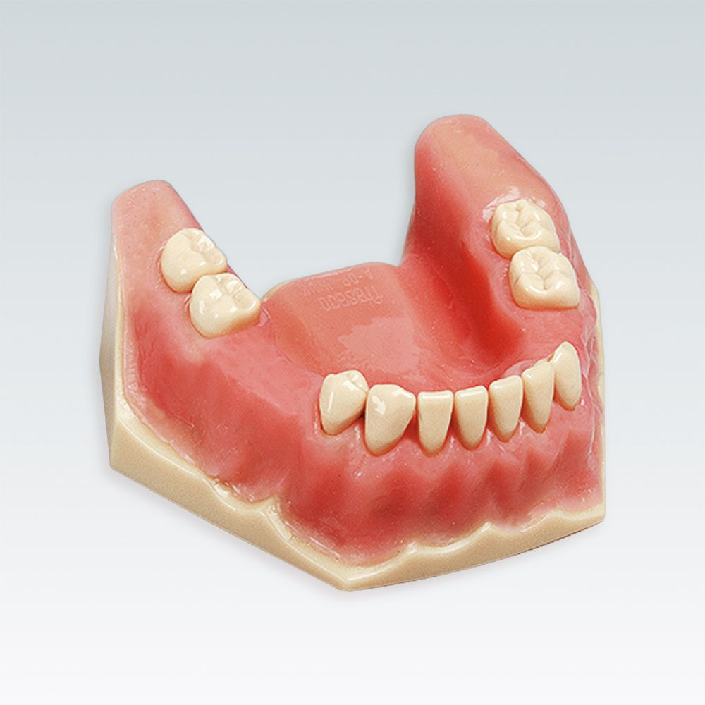 A-OP UK Стоматологическая модель нижней челюсти с дистопией зуба мудрости