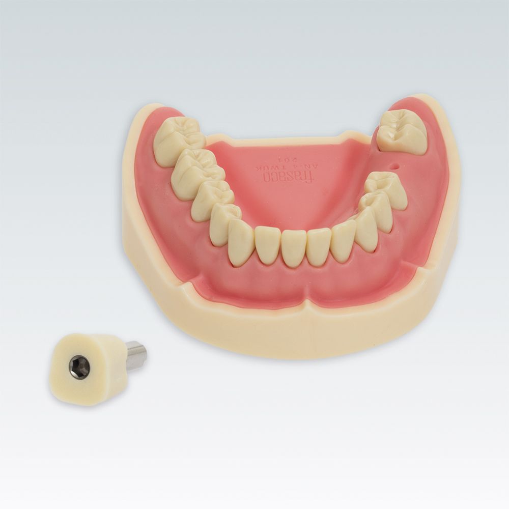 ANA-4 TUKV201 99-001 Стоматологическая модель нижней челюсти с аналогом импланта зуба №36