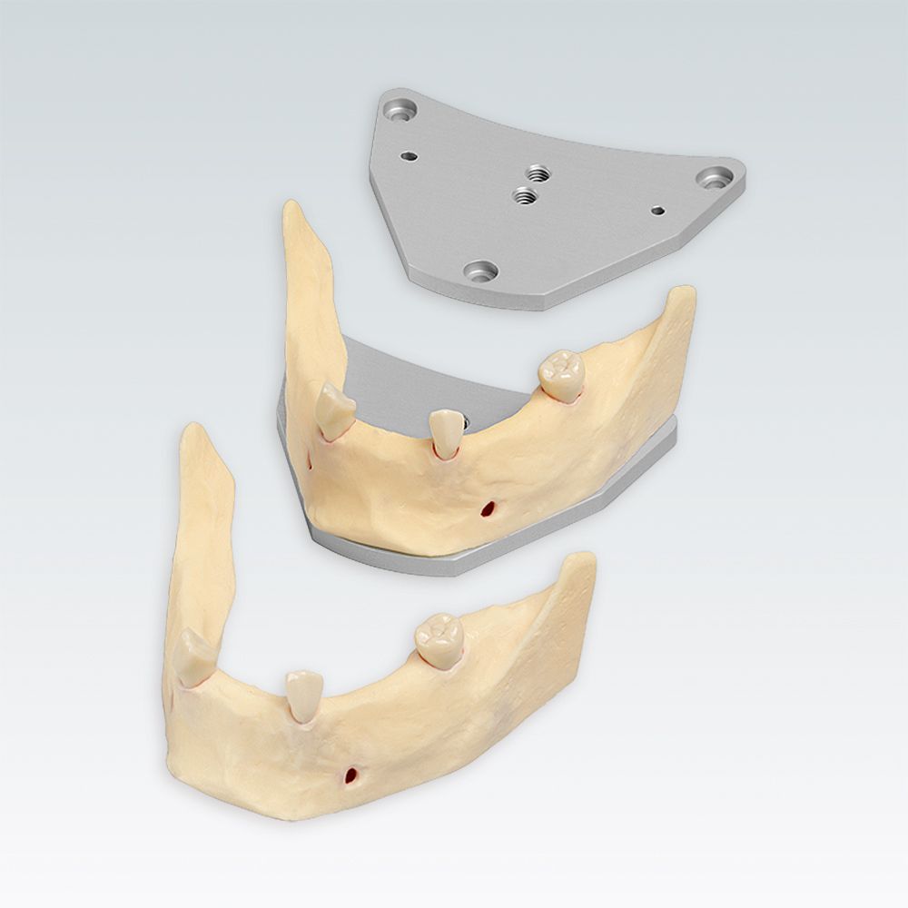 A-J F UK Стоматологическая модель нижней челюсти для имплантологии