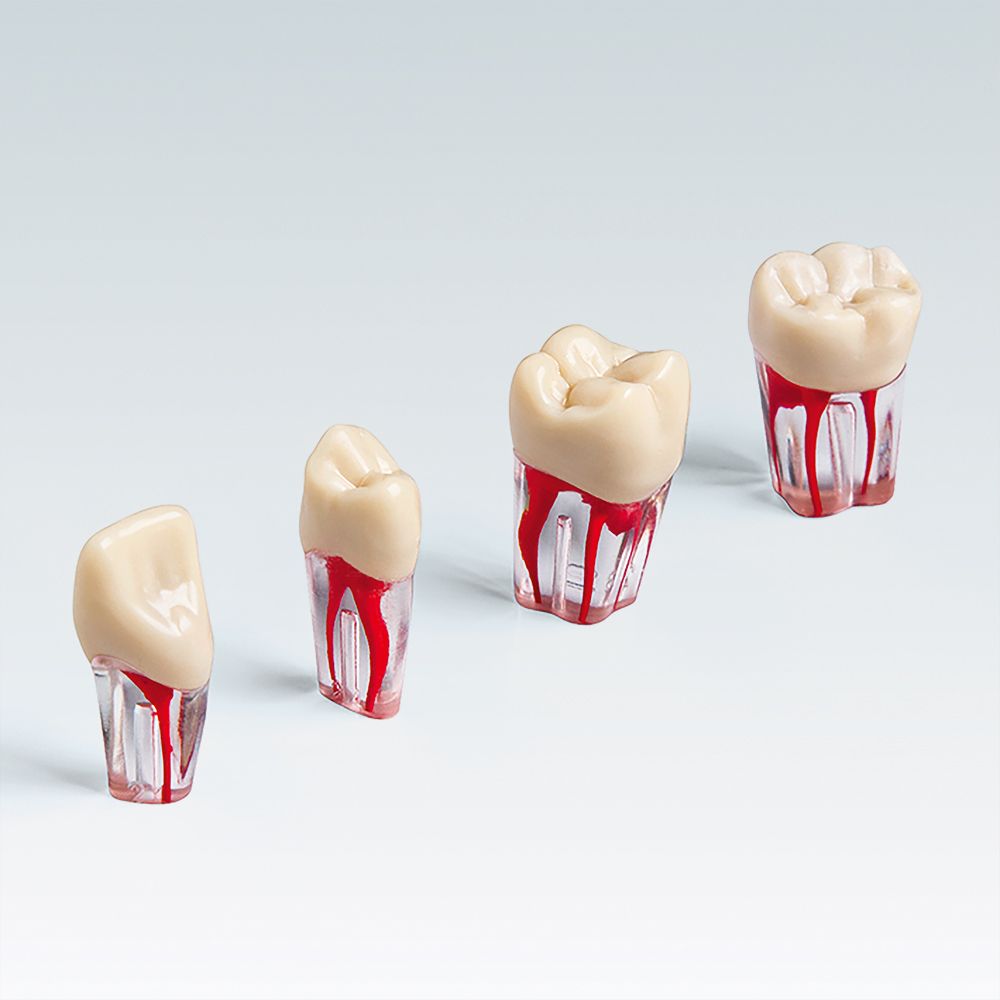 4 канала в зубе